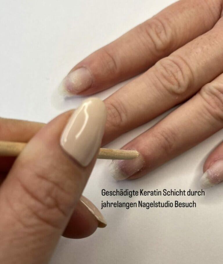 Was Tun Gegen Duenne Fingernaegel
